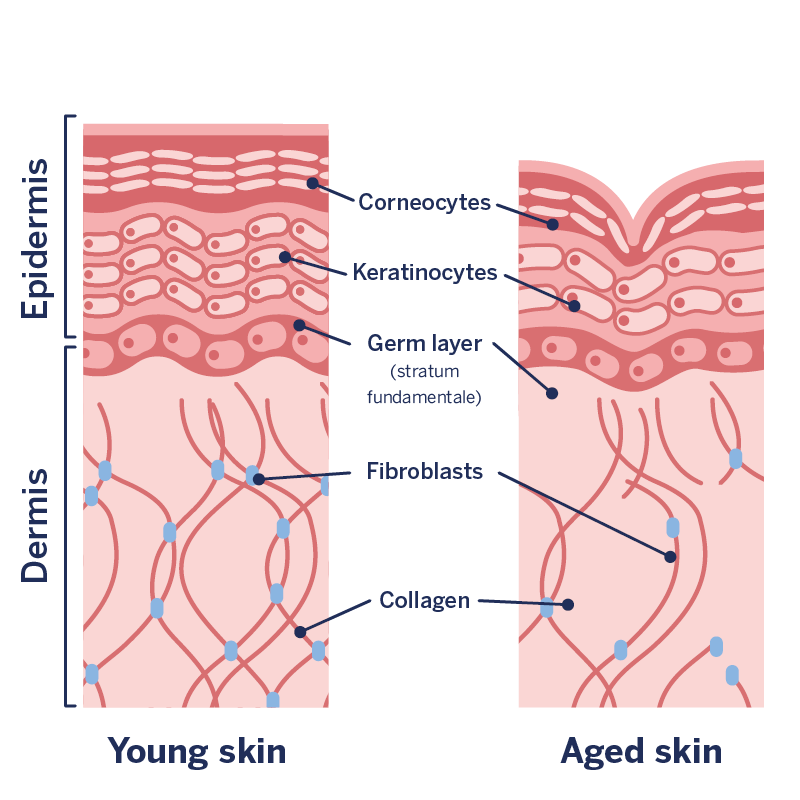 Wrinkles are caused by different processes in the skin Graphic of skin ageing or wrinkling