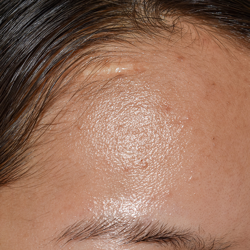 Gros plan du front gras