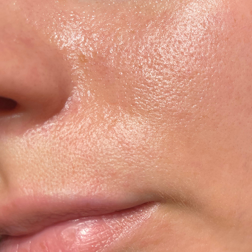 Gros plan des grands pores