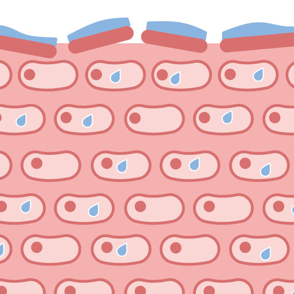 [Translate to Niederländisch:] Grafik trockene Haut