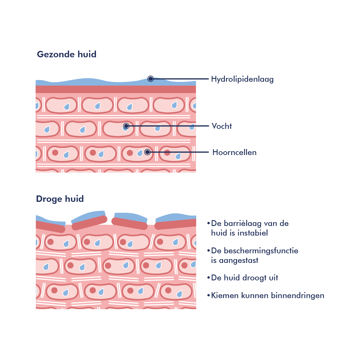 Huidafbeelding: atopische huid