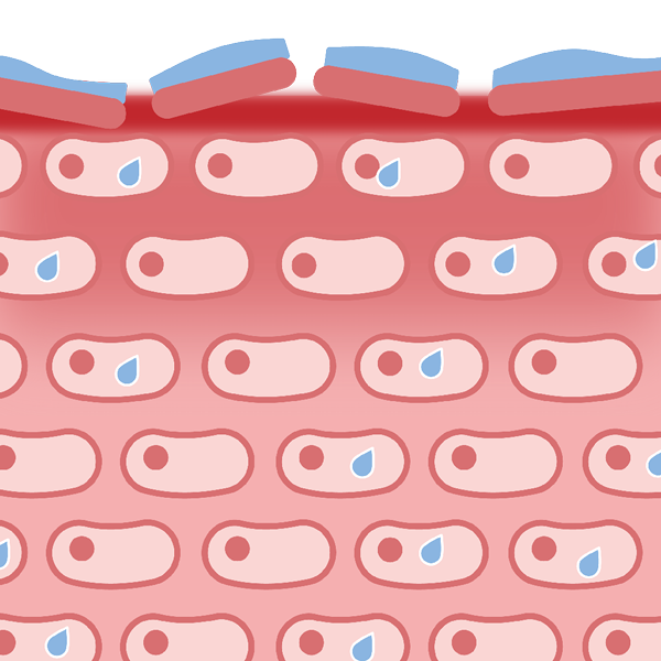 La barriera cutanea è instabile in caso di pelle sensibile e irritata. Immagine della pelle: Pelle irritata