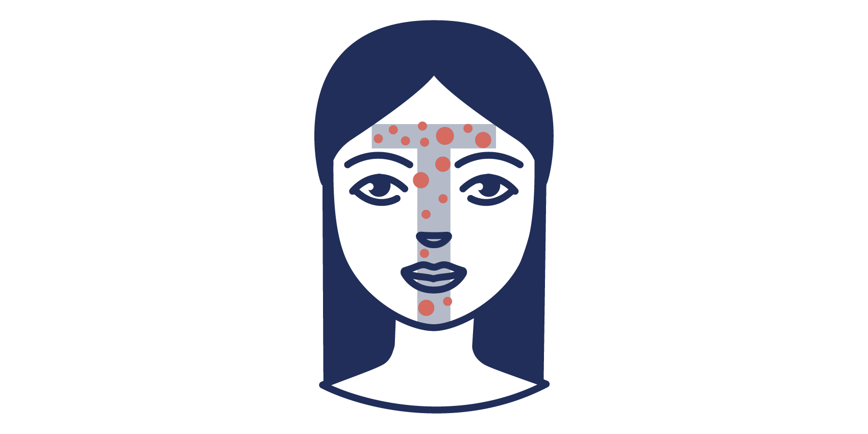 [Translate to Englisch:] Illustration der Acne vulgaris in der T-Zone