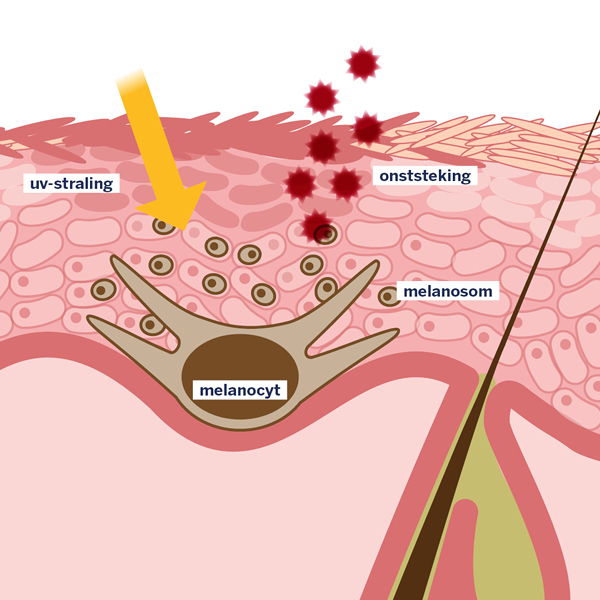 post-inflammatoire hyperpigmentaties