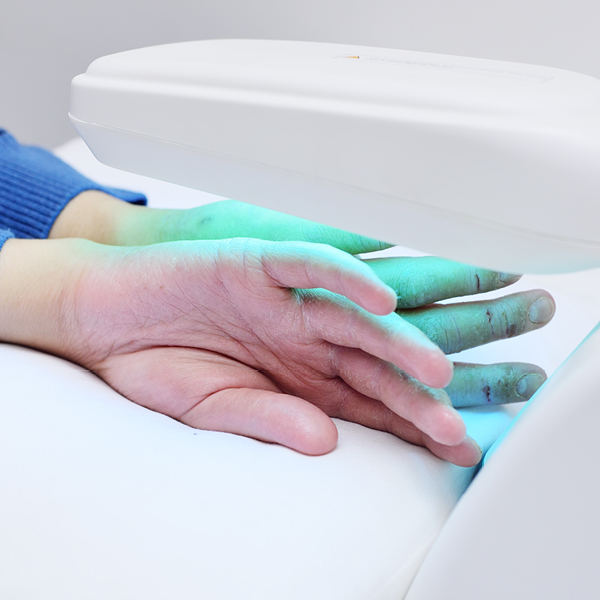 Twee handen onder een uv-lamp