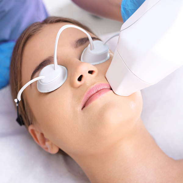 Lasertherapei bij teleangiëctasieën