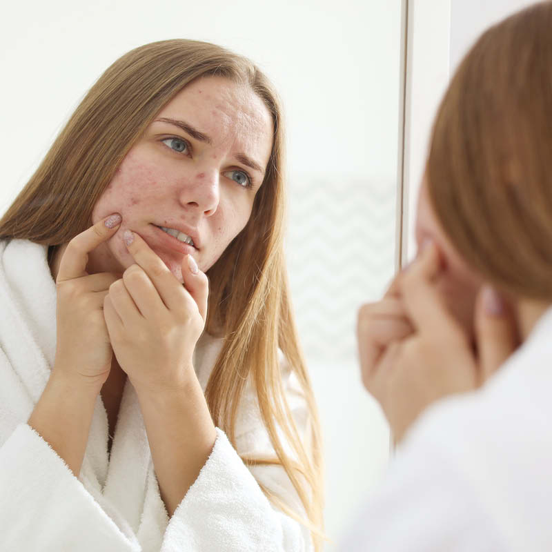 Een vrouw bekijkt haar acne tarde op de wang in de spiegel