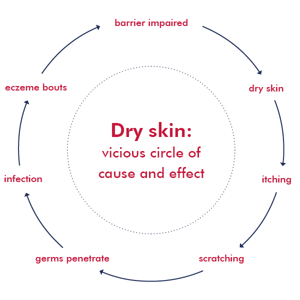Infographics about the itchy vicious circle