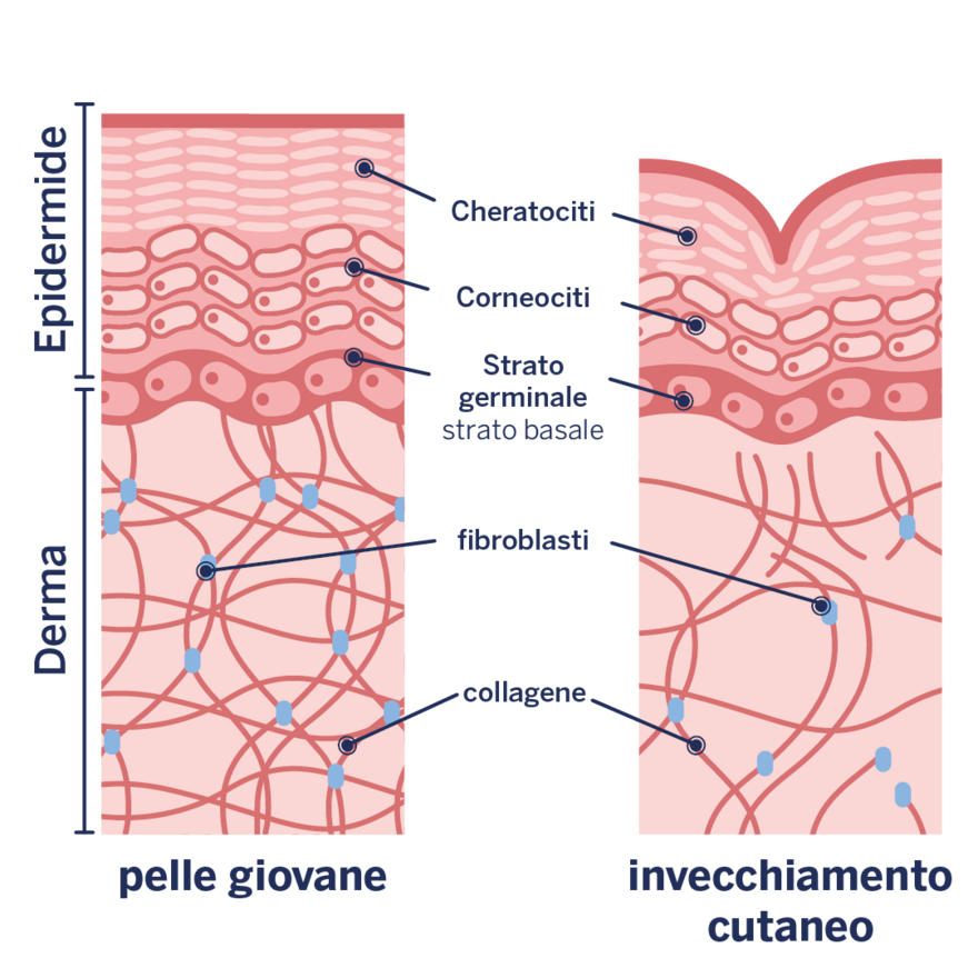 Immagine dell'invecchiamento cutaneo o della formazione di rughe