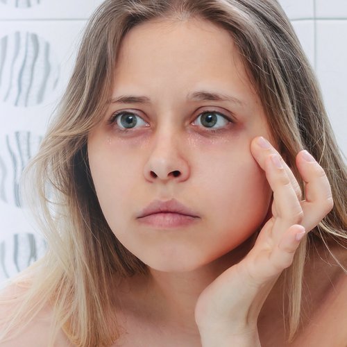 Vrouw met droge huid raakt haar gezicht aan