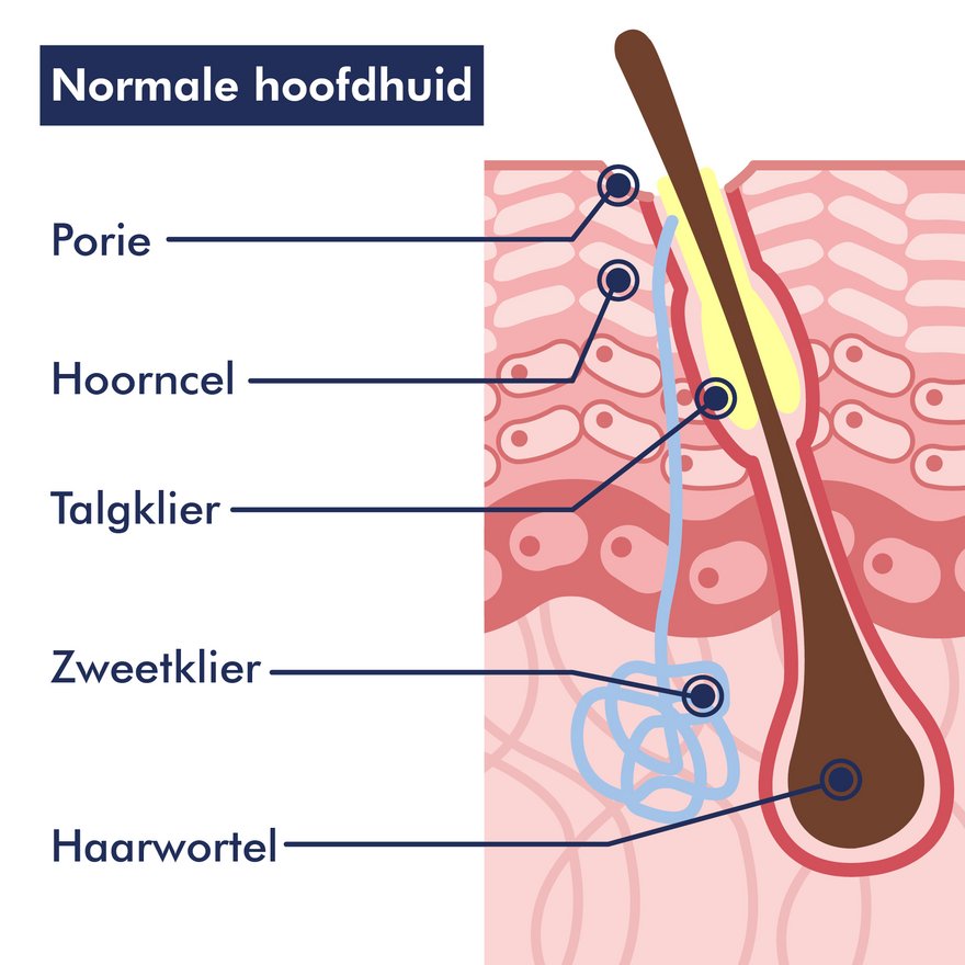 Een gezonde hoofdhuid is vrij van overmatige roos en jeuk Grafiek van een gezonde hoofdhuid
