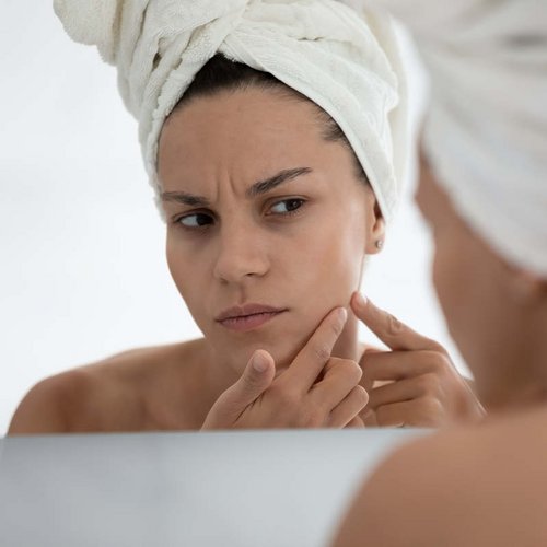  Vrouw knijpt puistjes uit na het douchen