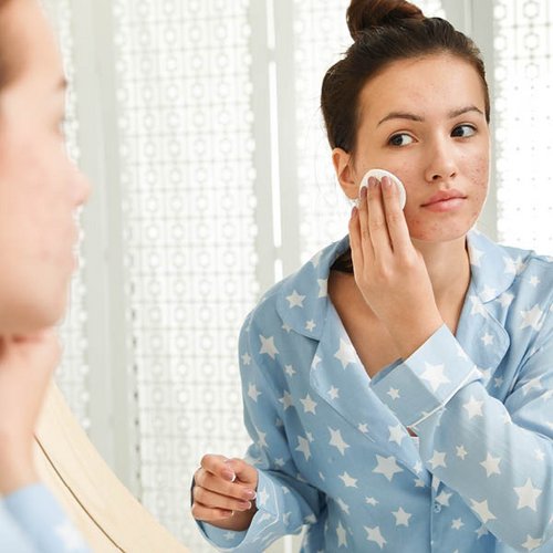 Een jonge vrouw bekijkt haar acne in de spiegel.