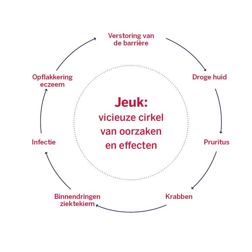 Infographic die de vizieuze cirkel van jeuk aantoont