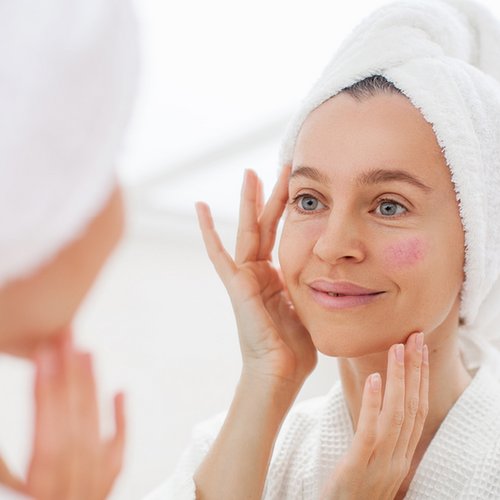 Vrouw bekijkt haar teleangiëctasieën in de spiegel