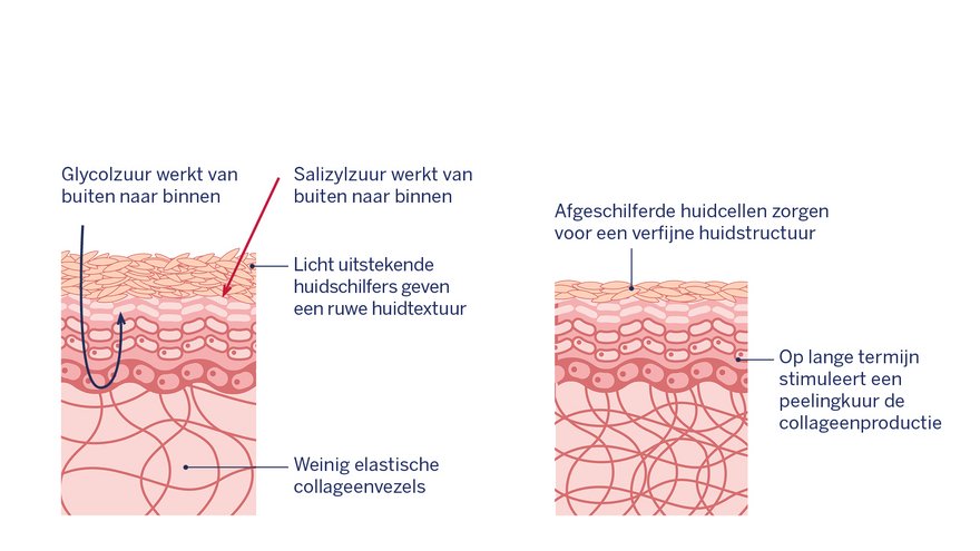 Grafisch: Huidveranderingen na het aanbrengen van fruitzuren