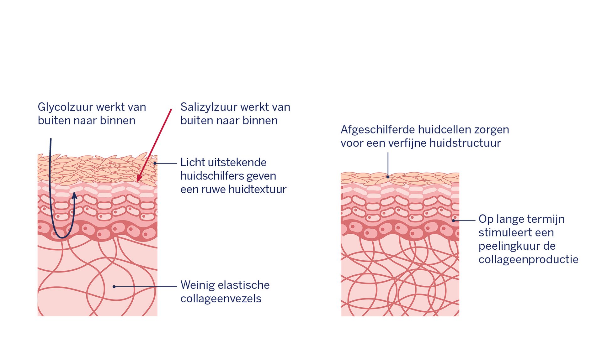 Grafisch: Huidveranderingen na het aanbrengen van fruitzuren
