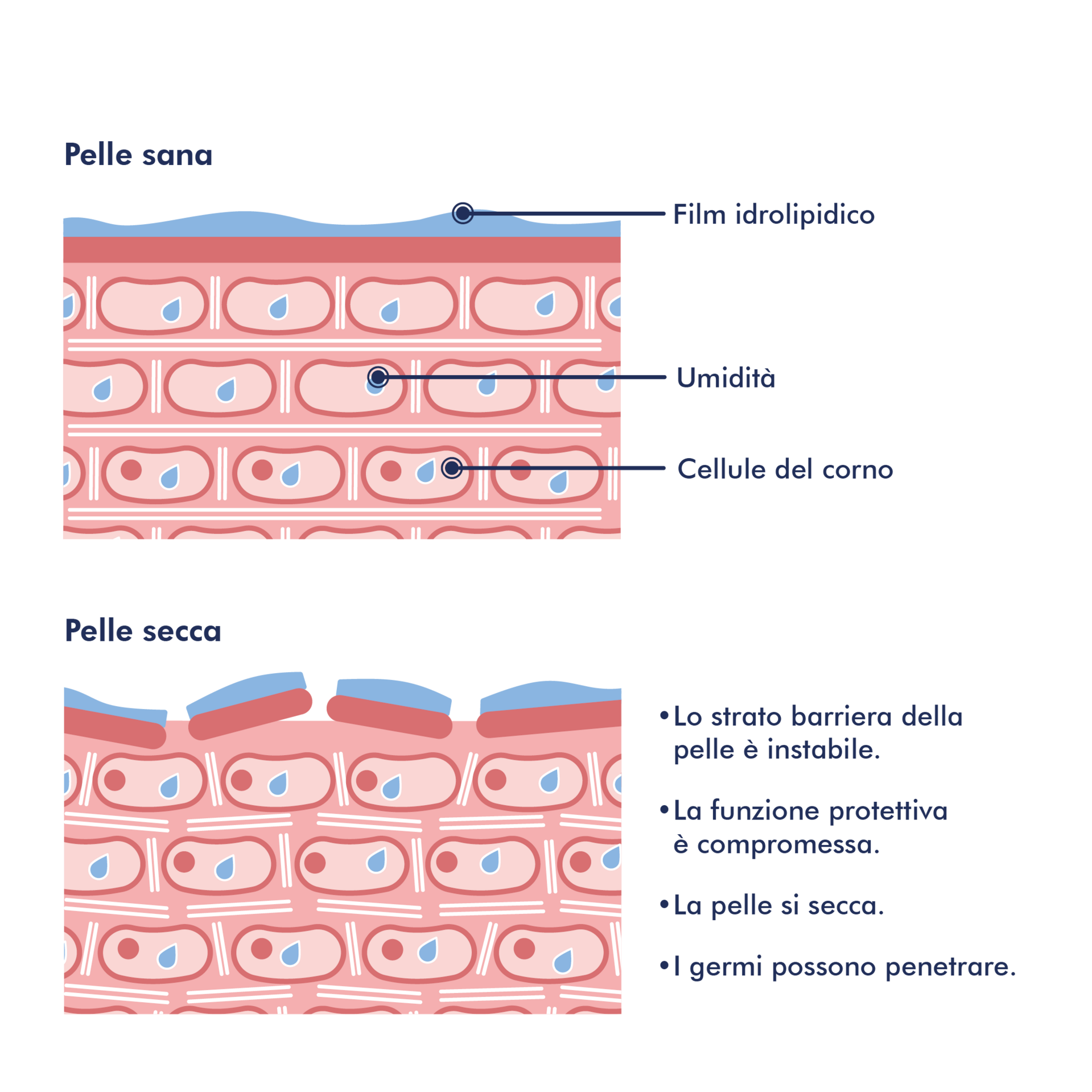 Immagine della pelle: Pelle con dermatite atopica