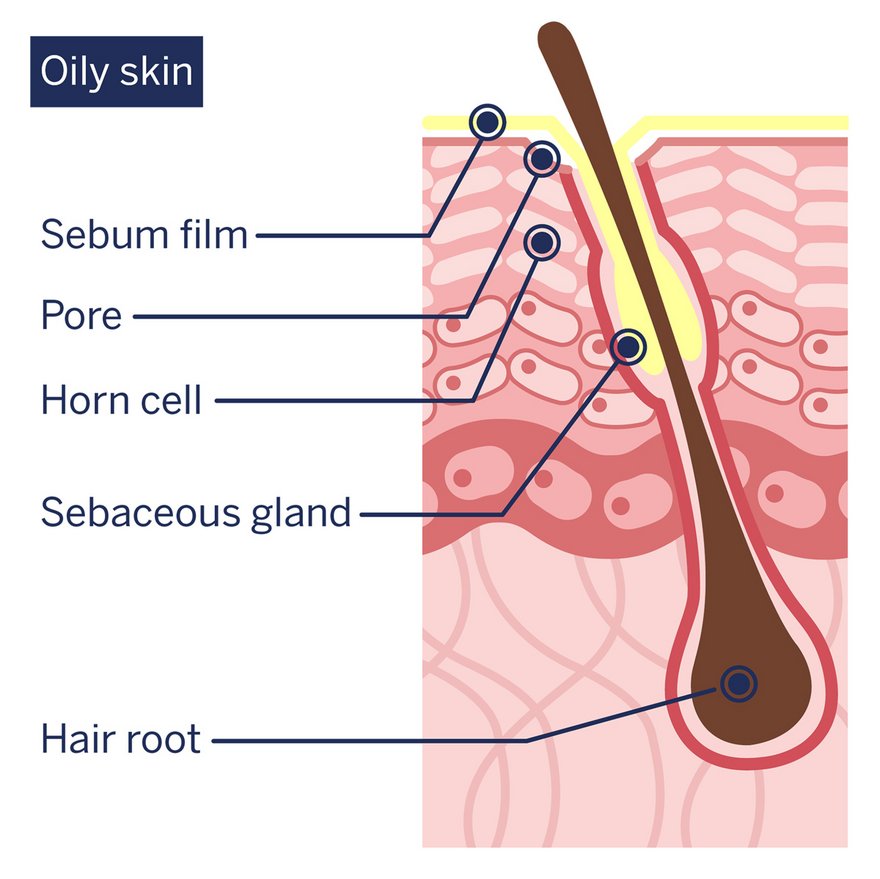 Schematic depiction: Composition of oily skin