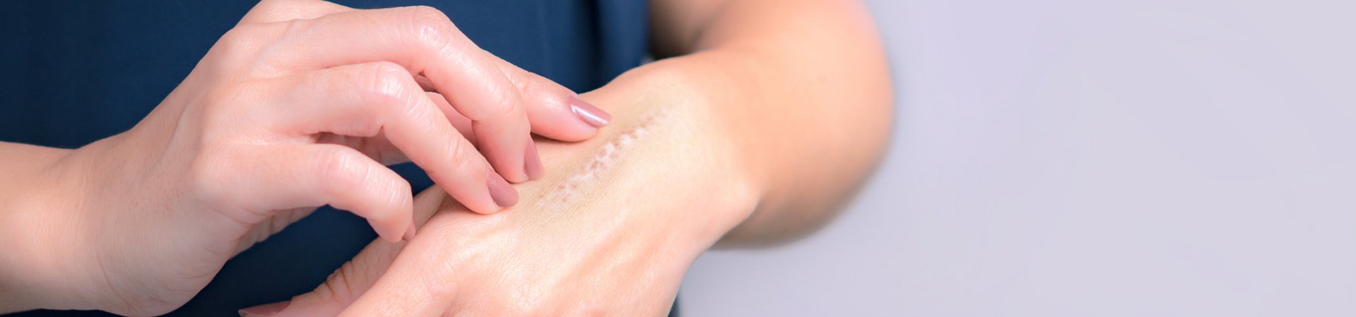 Facilita la guarigione di ferite e cicatrici con una cura adeguata. Donna che indica la cicatrice sulla mano