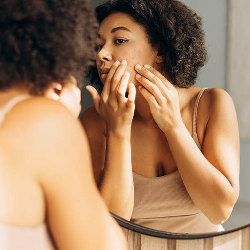 [Translate to Niederländisch:] Frau betrachtet ihre Wangenpartie im Spiegel