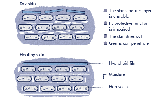 Skin with neurodermatitis before and after skin care Graphic showing the effect of skin care for neurodermatitis